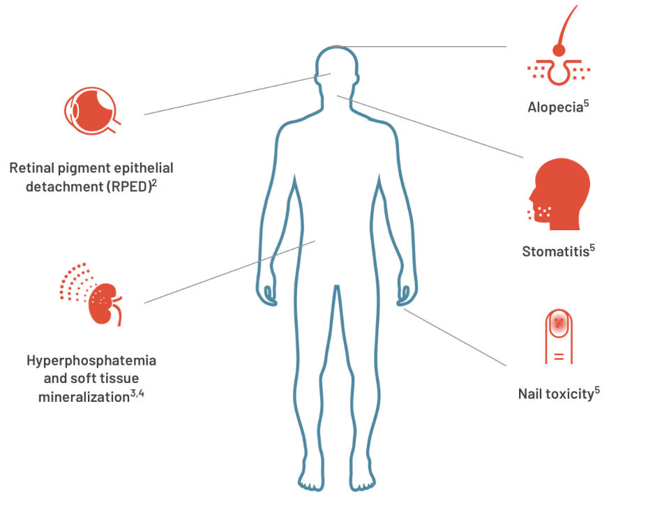 Graphic outline of a man surrounded by icons representing areas of the body affected by adverse reactions