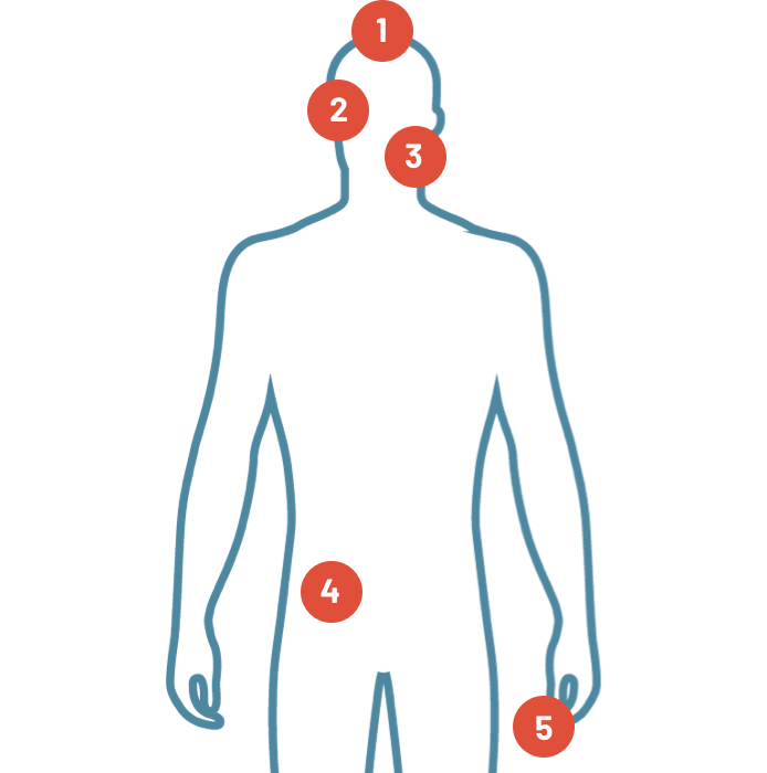Graphic outline of a man surrounded by icons representing areas of the body affected by adverse reactions